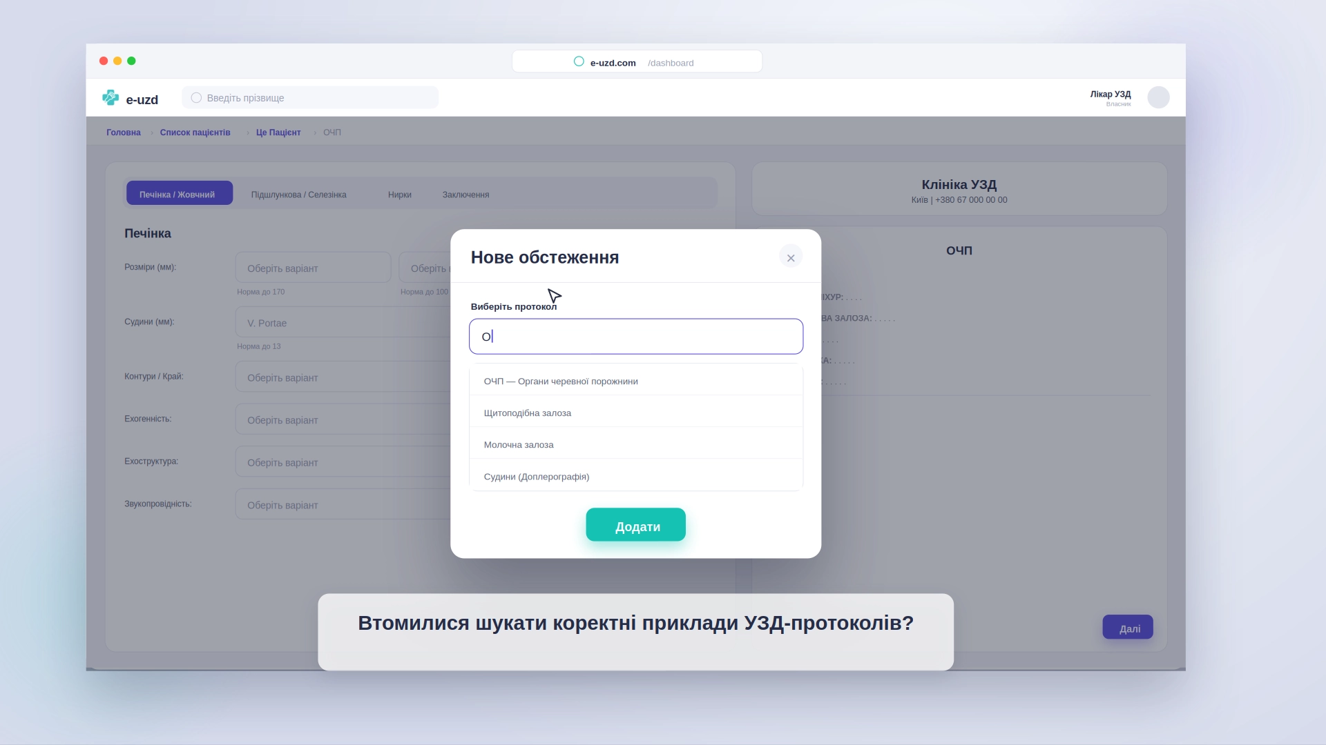 e-uzd — вибір протоколу УЗД